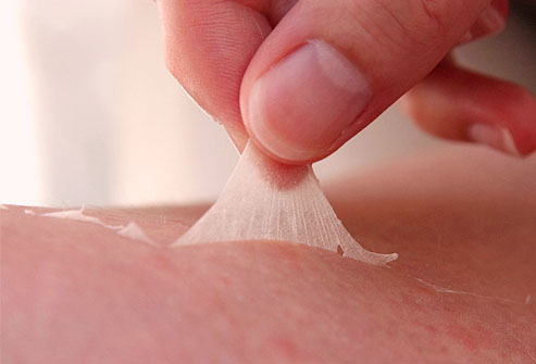 Treating Sunburn Peeling The Easy Way